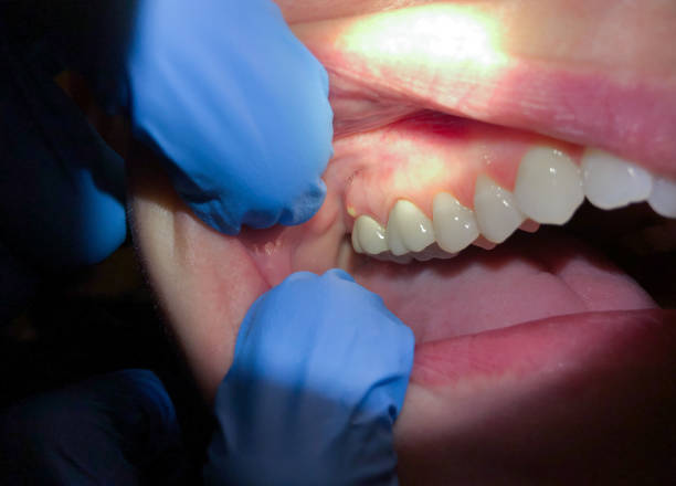  Rossville, MD Emergency Dentist Pros