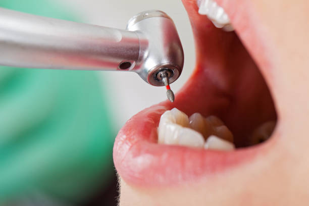 Best Emergency Broken Tooth Repair in Rossville, MD